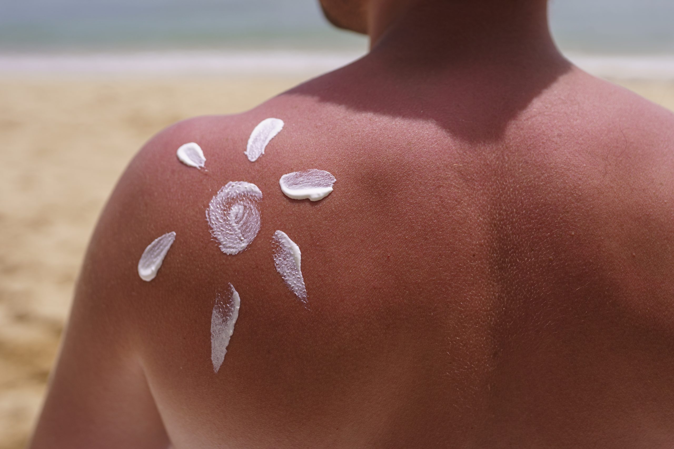 come togliere gli aloni di crema solare da vestiti e asciugamani. Macchie ostinate rimosse con rimedi naturali